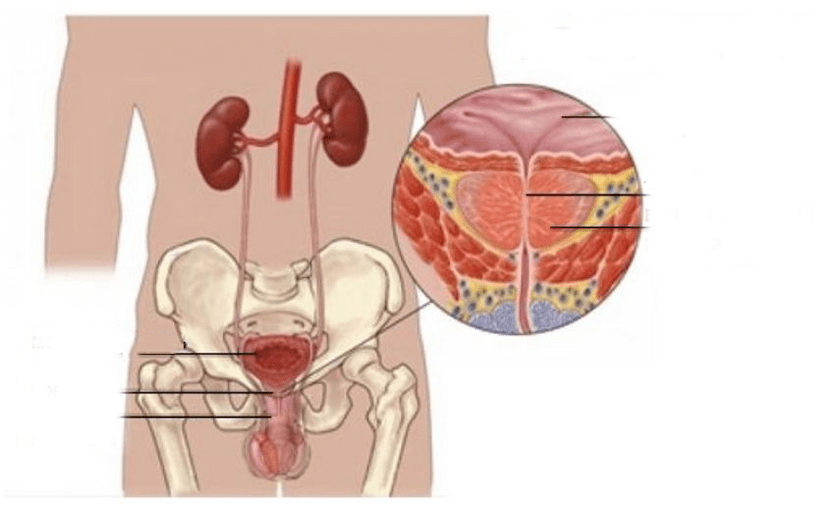 Προστατίτιδα στους άνδρες